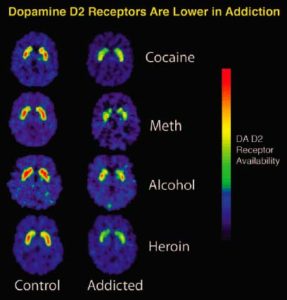 dopamine_d2_receptors_in_addiction